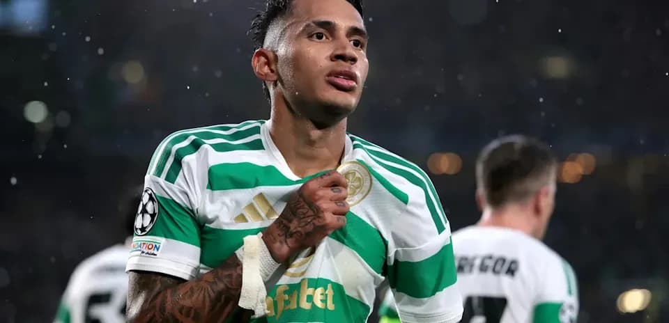 Jugador de Celtic celebrando con camiseta del equipo