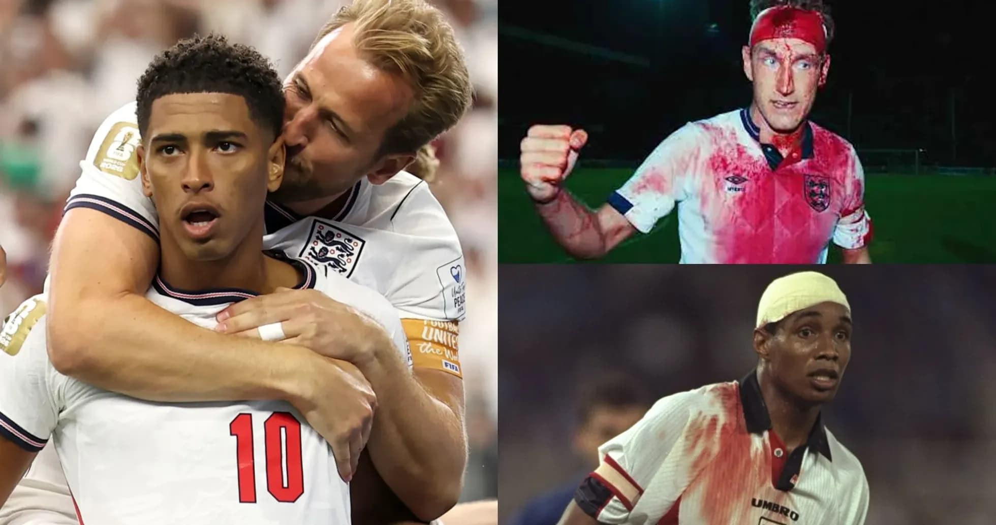 Jugadores de Inglaterra en momentos de acción y lesiones
